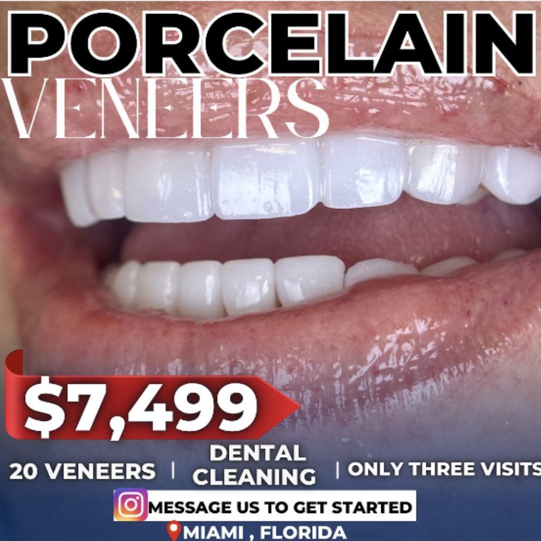 Beware the Bargain: Exposing the Truth About Cheap Veneers