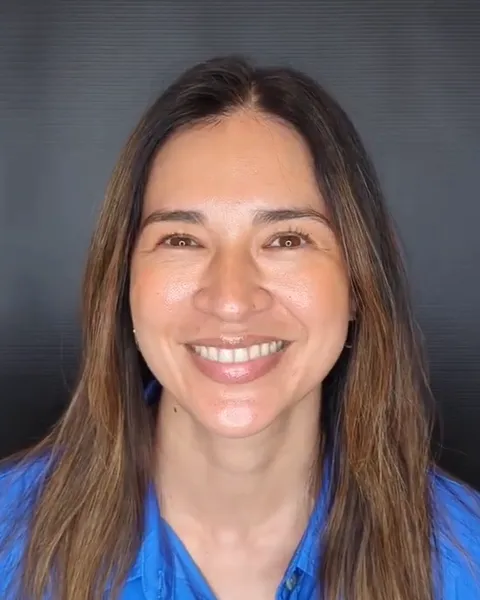 Christine, an Invisalign guest at Deering Dental, talking about her treatment