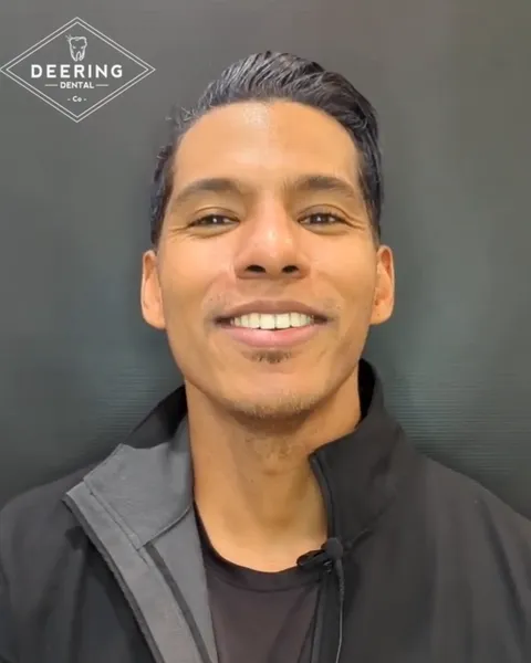 Jason, an Invisalign guest at Deering Dental, smiling after his treatment