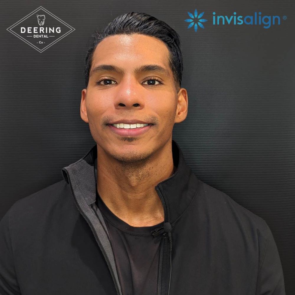 Invisalign Dentist Palmetto Bay Deering Dental in Palmetto Bay, near Pinecrest After Invisalign Treatment